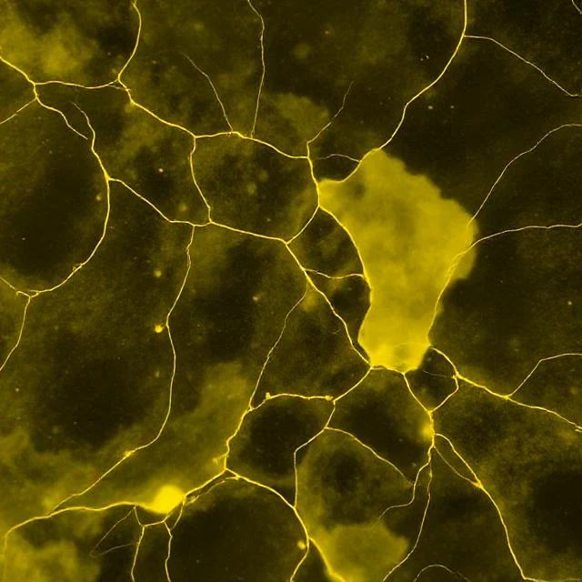 What Does Yellow Discharge Mean